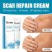  Anshka Organic scar removal gel natural scar therapeutic gel scar removal cream for old scars scar repair gel cream for men and women 1 piece - Buy Online on GoSupps.com