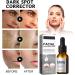 Trendyfave Facial Brightening Serum Face Moisturiser Hydrating Serum Face Serum for Women & Men Face Serum With Hyaluronic acid Squalane Shea Butter and Vitamin E Serum for Face Care - Buy Online on GoSupps.com