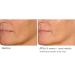 NassifMD Night Therapy Serum - Revitalize Skin Overnight | Shop Internationally - Buy Online on GoSupps.com