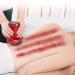 Electrical cupping therapy device with GUA SHA Schrupp and Warmth Schnapmassagger t rechargeable adjustable handcap for losing weight and tightening relaxing red