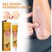 Bee Venom Psoriasis Treatment Cream - Soothing and Moisturizing | Professional New Zealand Formula for All Skin Types (1pcs) - Buy Online on GoSupps.com