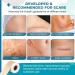 Silicone Scar Sheets Tape (1.6 x 60 Roll) - Professional Scar Removal for Surgical Scars, Keloid, C-Section, Burn, Acne - Brown - Buy Online on GoSupps.com