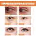 QGuoJie Lutein & Vitamin C Rollerball Eye Serum Oil AntiAging Essence for Dark Circles Puffy Eyes & Wrinkles Lightens Under Eye to Reduce Bags & Seize Serum 2 - Buy Online on GoSupps.com