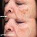 Dark Spot Remover for Face and Body Freckle Removel Cream Pigmentation Removal Melasma Cream Dark Spot Corrector Dark Spot Remover for Face Age Spot Remover for Face Dark Age Spot Remover - Buy Online on GoSupps.com