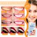 Keepaty Tooth Whitening Strips for Sensitive Teeth - 14 Strips to Remove Smoke Coffee Soda & Wine Stains - 1-Week Treatment - Buy Online on GoSupps.com