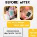 Deep Cleansing Foot Pads | Lavender Foot Patches for Better Sleep & Foot Care | Organic Japanese Herbal Ingredients | 14 Pads to Cleanse & Energize - Buy Online on GoSupps.com