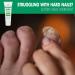 Toenail Softening Cream for Thick Hard Nails | Aloe Infused 1 Oz | Temporary Nail Care Solution - Shop Internationally - Buy Online on GoSupps.com