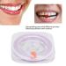 Premium Dental Polishing Strips - 50um Close Fitting Tooth Polisher for Perfectly Polished Teeth | International Shipping Available - Buy Online on GoSupps.com