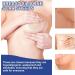 WWDZ 4 Pairs Breast Scar Sheets - Surgical Scar Removal Patches for Healthy, Flattened, and Faded Scars - Buy Online on GoSupps.com