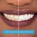 Go SMiLE Teeth Whitening Gel 3.4 OZ - Fast-Acting Formula for Brighter Smile - 3.4 Ounce (Pack of 1) - Buy Online on GoSupps.com