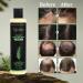 Shampooing bio pour la croissance des cheveux au romarin pour femmes et hommes shampooing naturel pour renforcer et paissir avec k ratine hydrolys e pour cheveux fins et perte de cheveux 7 4 ml - Buy Online on GoSupps.com