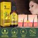 Ginger Hair Growth Serum - Anti Hair Loss Treatment for Men & Women - Buy Online on GoSupps.com