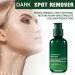 Hyaluronic Acid Facial Serum Hyaluronic Acid Serum Anti Wrinkle Serum Dark Spot Remover for Face Hyaluronic Acid Face Serum for Women Face Moisturiser Skin Tightening Hydrating Plump Skin - Buy Online on GoSupps.com