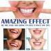 Parodont Gums Gel - 4ml Gum Care Tooth Whitening Essence for Swollen Gums Stain Removal & Teeth Brightening (3 Pack) - Buy Online on GoSupps.com