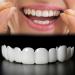 2 Pairs Regain Confidence Smile for Women and Men