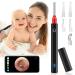 Earwax Removal Tool Urbesty Ear Wax Removal Camera with Light 1080P HD Wireless Ear Endoscope Earwax Removal Kit 3.5mm Mini Wireless Otoscope Ear Cleaning Camera with Reusable Ear Spoons Set Black