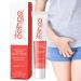 Jacekee itching relief for the genital area |Soothing and refreshing anti-itching cream-itching relief to relieve dryness itching burning redness cream