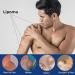Cr me Naturelle d' limination des Lipomes Cr me d' limination des Lipomes Cr me pour l' limination des Lipomes Cr me D' limination des Lipomes V g taux Lipoma Removal Cream 20g 2PC - Buy Online on GoSupps.com