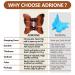 ADRIONE 100 Pack Tortoise Mini Brown Butterfly Hair Clips for Women - Strong Small Clips for Hair Design - Buy Online on GoSupps.com
