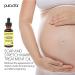PURA DOR Organic Scar & Stretch Mark Treatment Oil | 1oz For Skin - Rosehip, Wheat Germ, Argan, Tamanu, Carrot, Rosemary, Lavender, Geranium, Patchouli, Sage - Buy Online on GoSupps.com