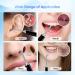 Aeasycozy Ear Wax Removal Kit with 3 Million Pixel 1296P HD Camera - Wireless Ear Cleaner with 6 LED Light & 4 Ear Sleeve Set - Buy Online on GoSupps.com