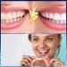 4-Pack Bite Rail Silicone - Anti-Snoring & Tooth Protection for Sports | Tooth Whitening Solution - Buy Online on GoSupps.com