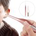 Rose Gold Earwax Removal Kit with Camera and Light - Beauty & Personal Care - Buy Online on GoSupps.com