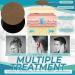 Effective Tinnitus Relief: 30 Herbal Ear Patches for Earache & Hearing Loss - Natural Treatment - Buy Online on GoSupps.com