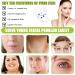 160 Pieces Invisible Face Lift Tape - Lifting & Firming Solution for Sagging Skin - International Shipping Available - Buy Online on GoSupps.com