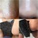 40 PCS Blackhead Remover Strips - Pore Strips for Nose, Face & Chin - Blackhead Removal for Nose & Forehead - Buy Online on GoSupps.com