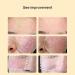 Red Light Face Mask for Skincare - 7 Color Variations | Portable At-Home Device for Fall & Winter Care - Buy Online on GoSupps.com