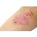 Blueline 10% Urea Cream 500ml | Body Cream for Very Dry Skin Psoriasis & Neurodermatitis | Itch Relief & Skin Care for Rashes & Blemishes - Buy Online on GoSupps.com