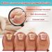 Fungal Nail Treatment Patches - Renewal Nighttime Anti Fungus Repair - Restores Healthy Nails - 16pcs - Buy Online on GoSupps.com
