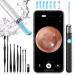 Jaydear Ear Cleaner/Ear Wax Removal Kit Ear Camera 1920P FHD Wireless Otoscope Portable USB Charging Kit with LED Lights Ear Cleaning kit for iPhone & Android Smart Phones Black Black-