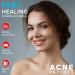 Acne Pimple Patches 120 Pack - Invisible Hydrocolloid Bandages with Tea Tree Oil for Spot Treatment - Blemish & Zit Stickers 120 Count - Buy Online on GoSupps.com