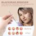 OCBA Blackhead Remover Tool | Professional Skincare Spot Treatment for Blemish, Comedone, Whiteheads, Pimple | Double Sided Soft Touch | Anti-Slip Design - Buy Online on GoSupps.com