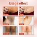 BLEDD Acantho Clear Therapy Spray - Dark Knuckles & Spots Corrector Oil (3pcs) - Buy Online on GoSupps.com