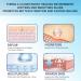 Silicone Scar Sheets - Reusable & Effective for Scar Removal - Pack of 6 Silicone Removal Strips for Surgical Scars, Keloids, C-Section, Tummy Tuck - Scar Tape - Buy Online on GoSupps.com
