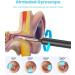 BEBIRD Ear Wax Removal Kit - LED Ear Cleaner with Otoscope for Android & iPhone - Smart Earwax Remover for Adults & Kids - Buy Online on GoSupps.com