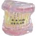 Dental Orthodontic Demonstration Model Dental Teeth Orthodontic Retainer Treatment Model with Metal Self-ligating Brackets Explaining Model - Buy Online on GoSupps.com