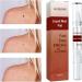 Skin Tag Removal Skin Tag Remover Mole Remover Pen Skin Tag Remover Pen Natural Non-Irritating Skin Tag Remover for All Skin Types - Buy Online on GoSupps.com