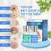 Skin Tag Remover - All Natural Mole and Skin Tag Removal Lotion - Scar-Free and Safe Solution - Buy Online on GoSupps.com