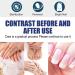 Tlopa Nail Growth And Strengthening Serum Nail Growth and Strength Serum Toenail Growth Treatment for Damaged Nail Stronger Nails in 1 Week Nail Strengthening Treatment (2PC) - Buy Online on GoSupps.com