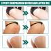 Cr me Nettoyante Acn Fesses et Cuisses Cr me pour les Boutons des Fesses Nettoyage Cr me Dissolvant de Boutons pour les Fesses 100ML 1PC - Buy Online on GoSupps.com