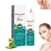 Scar Remove Advanced Scar Spray Scar Removal Spray for All Types of Scars Acne Scar Treatment for Face Acne Scars and Dark Spaot Remover Gentle Skin Care for Acne Prone Skin Scar Scars (1Pc)