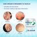 Seborrheic Dermatitis Cream - Fast-Acting Treatment for Face, Scalp, Folliculitis, Dandruff, Psoriasis - 3.4 oz - Buy Online on GoSupps.com