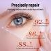 Retinol Eye Cream Anti Wrinkle Eye Cream For Dark Circles And Puffy Eyes Brightens Under Eye Eye Bags Remover Eye Serum For All Skin Types 30g - Buy Online on GoSupps.com