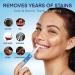 NC LIVING Teeth Whitening Pen 4-Pack 60+ Uses Brighten Your Smile in Just 1 Week with Tooth Whitening Kit - Fast Gentle Enamel Safe Whitening Gel for White Teeth - Buy Online on GoSupps.com