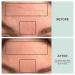 Dermaclara Silicone Face Patches for Wrinkles & Fine Lines | Anti-Wrinkle Treatment - Pregnancy Safe Skincare | Reusable Under Eye, Forehead & Face Wrinkle Patches - Buy Online on GoSupps.com