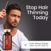 Histemo ION-TO G Scalp Serum: Hair Regrowth Treatment - Prevents Thinning & Loss, Peptides, Amino Acids, Growth Factors - Clinically-Proven for Growth - 1 Month Supply - Buy Online on GoSupps.com